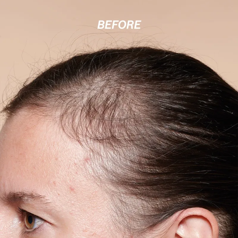 L'Occitane Anti-Hair Loss Serum 50mL