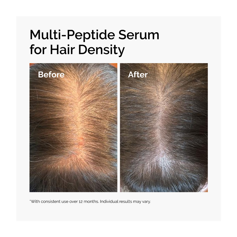The Ordinary Multi-Peptide Serum for Hair Density 30mL
