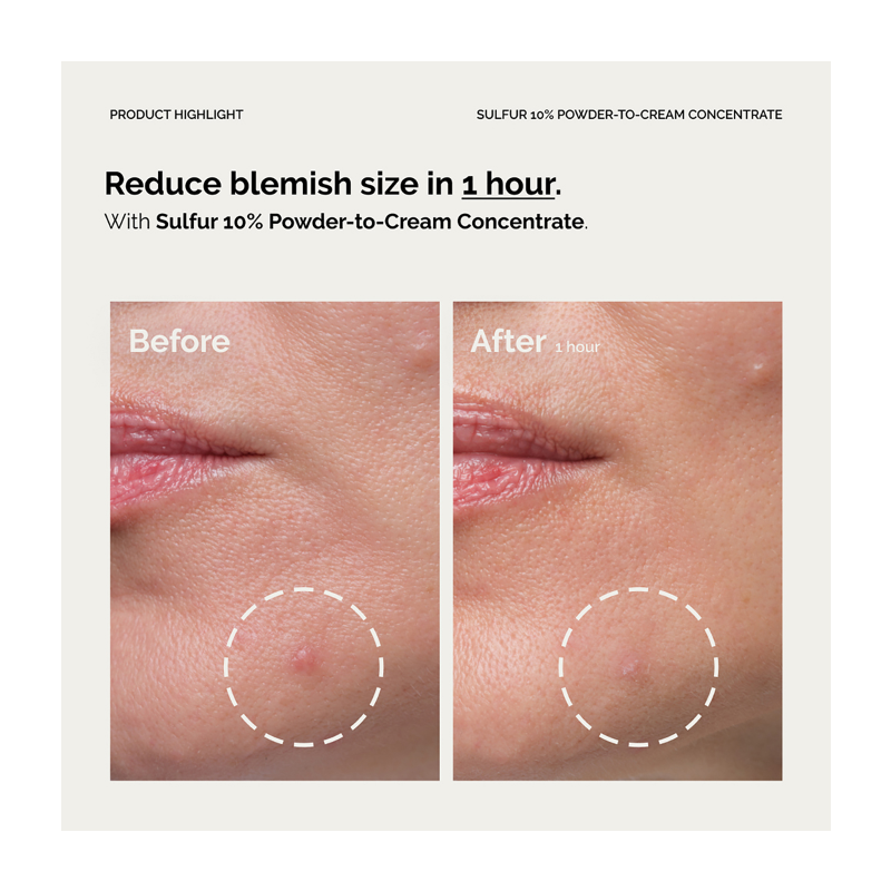 The Ordinary Sulfur 10% Powder-to-Cream Concentrate 5g