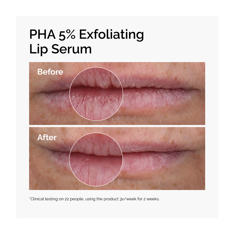 The Ordinary PHA 5% Exfoliating Lip Serum 15mL